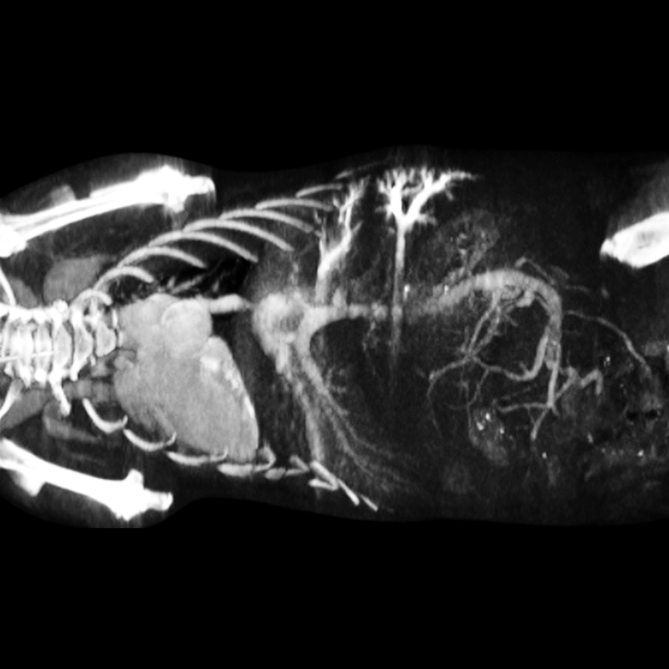 CT Contrast Agents