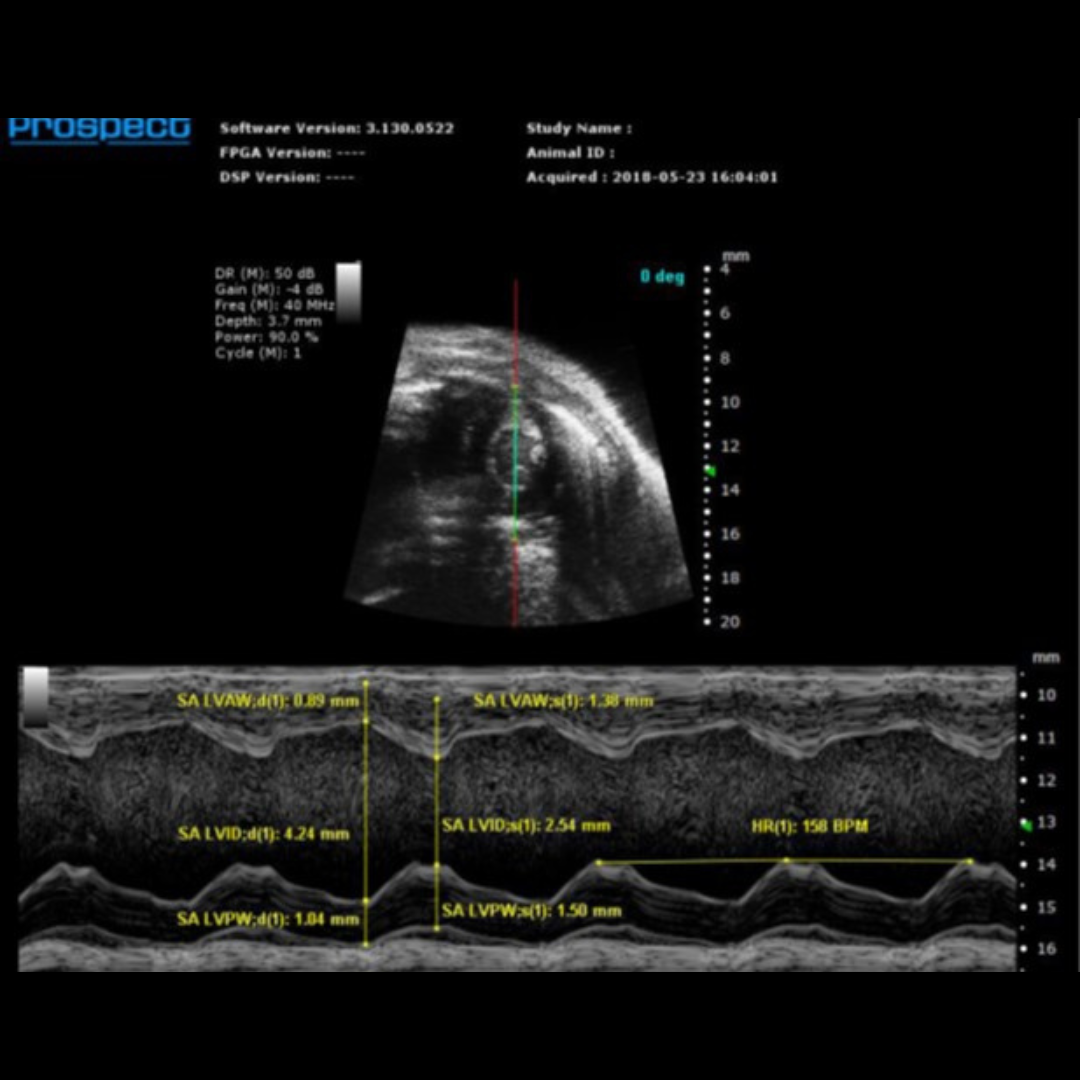 Prospect T2 Ultrasound