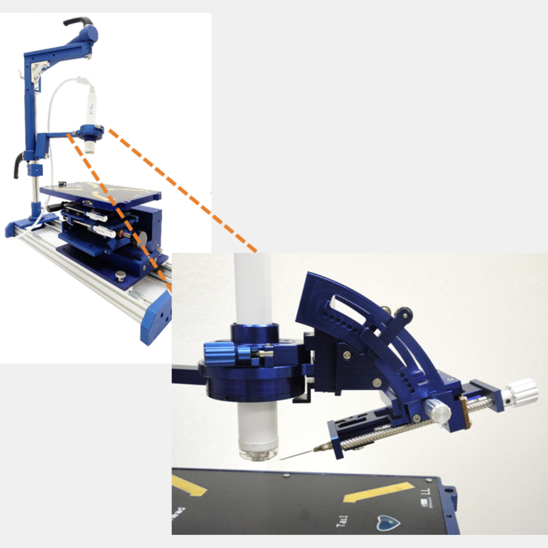 Prospect T2 Ultrasound