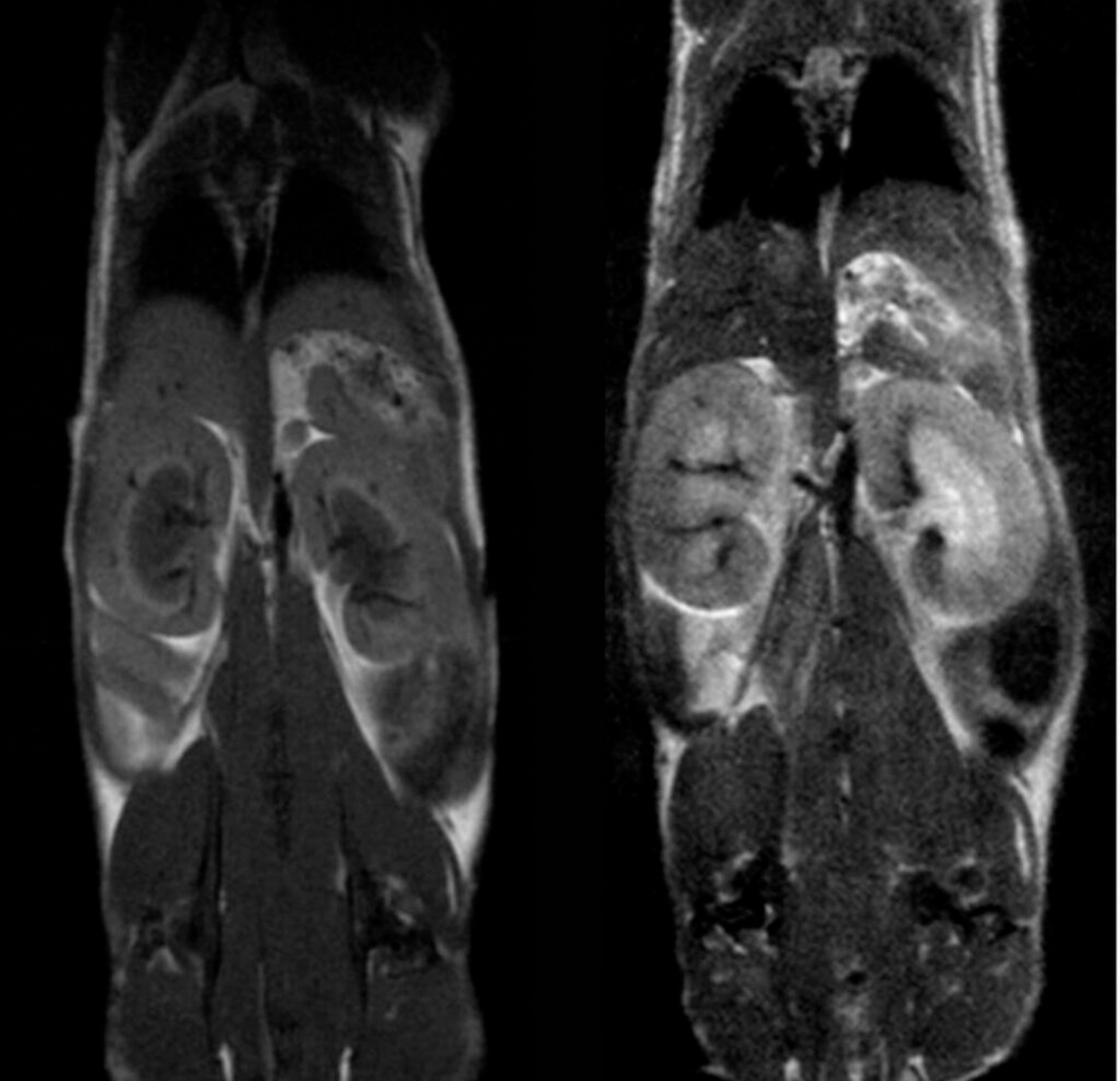 M-Series Compact MRI M5