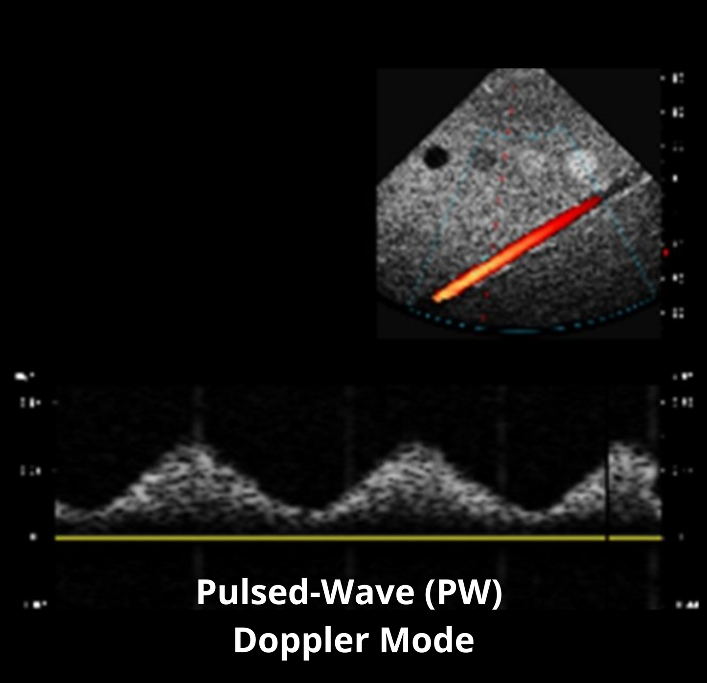 Prodigy Ultrasound