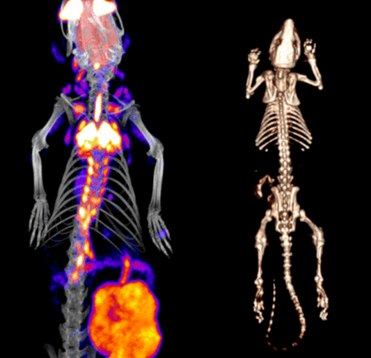 SuperArgus PET/CT