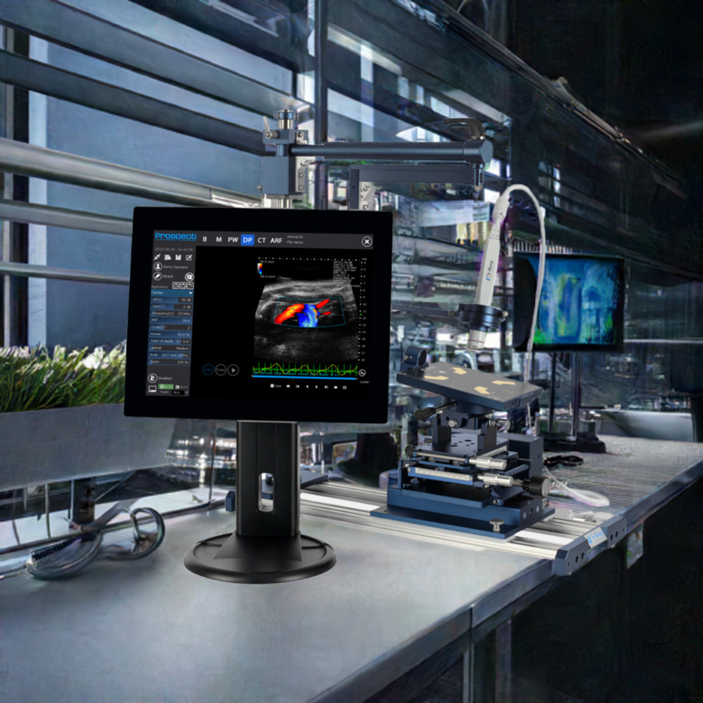 Prospect T2 Ultrasound
