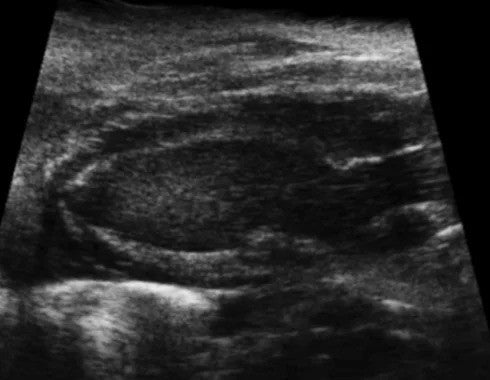 High-frequency Ultrasound