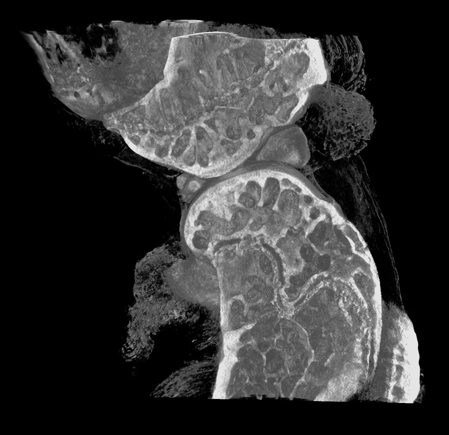 InCiTe™ 3D X-Ray Microscope